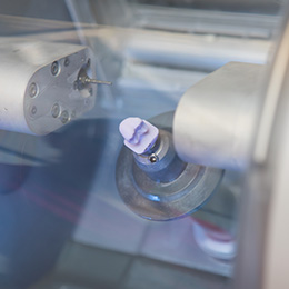 Apple Dentistry | Veneers, Invisalign reg  and Preventative Program